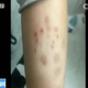 A sick student at Changzhou Foreign Languages School.